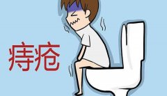 治療內(nèi)痔一般要花多少錢(qián)